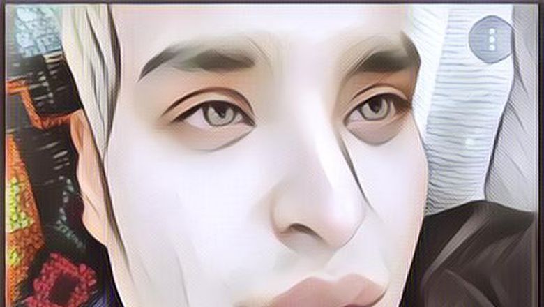 Viral Pria Melakukan Operasi Plastik Bak Filter IG, Hasilnya Bikin Terkejut