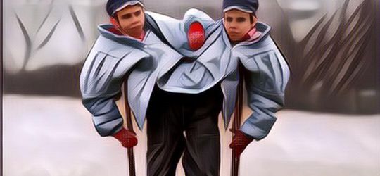 Kisah Kelam Kembar Siam yang Dijadikan Percobaan Sadis, Satu Tumbuh Jadi Psikopat Satunya Penuh Empati