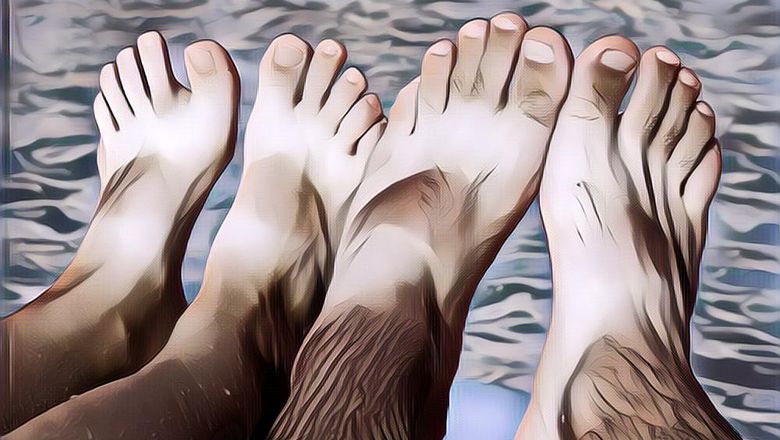 Kamu Wajib Tahu! Tips Mengatasi Kulit Belang Akibat Sinar Matahari