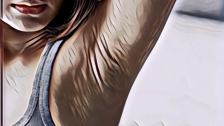 Penyebab dan Tips Membersihkan Ketiak Hitam