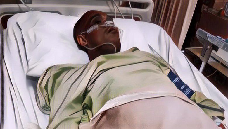 Muncul Gelembung Hitam, Kaki Sapri Pantun Terancam Diamputasi