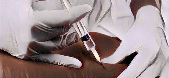 Mengenaskan! Wanita Ini Tewas Setelah Suntik Silikon di Bokongnya Hingga 15 Kali