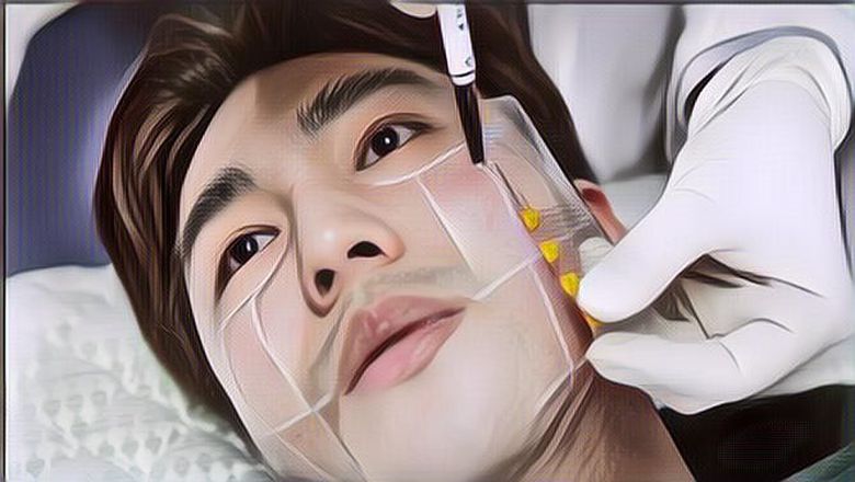 Emang Sih Bikin Cantik dan Ganteng, Tapi Ini Dampak Operasi Plastik yang Harus Diketahui