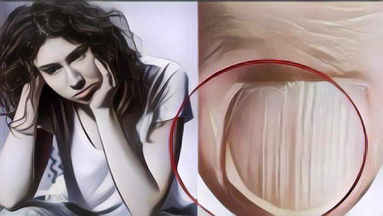 Ini yang Terjadi pada Tubuhmu Jika Kekurangan Protein