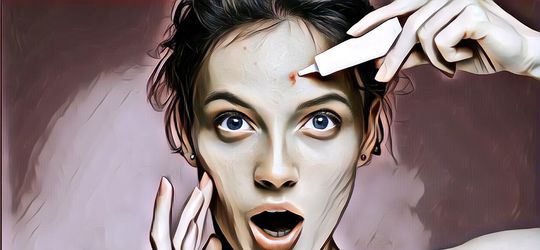 Cegah Wajah Berantakan dengan Cara Menghilangkan Jerawat Kecil Ini