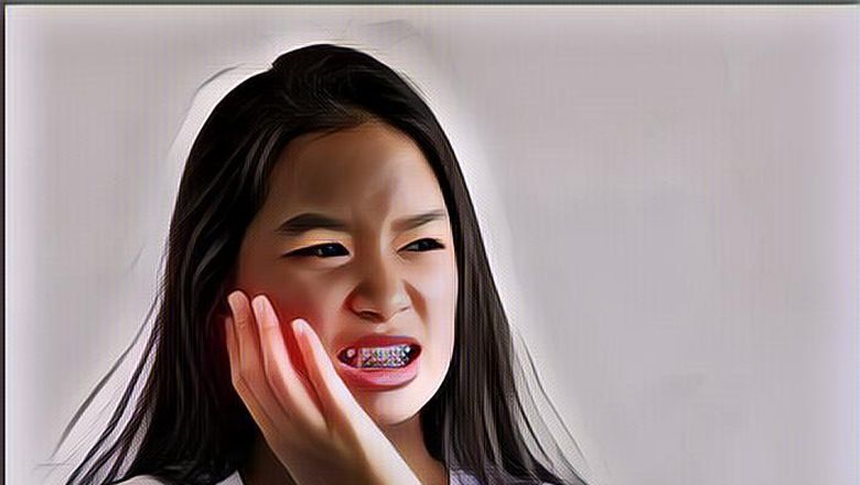 Cara Menghilangkan Sakit Gigi dalam 5 Menit, Ampuh Langsung Enakan!