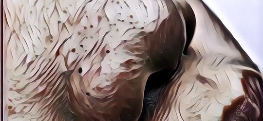 Cara Menghilangkan Komedo di Hidung: Auto Bersih!