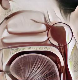 Mengenal Apa Itu Adenoid yang Sering Diderita Anak dengan Alergi, Apakah Bisa Sembuh Sendiri?