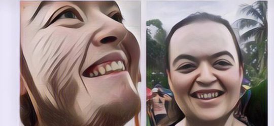 Berjuang Hilangkan Jenggot Selama Bertahun-Tahun, Wanita Ini Memutuskan Hidup Bebas