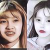 Seorang Influencer China Operasi Hidung Agar Mancung, Endingnya Malah Apes