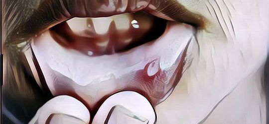 Cara Mengobati Sariawan Biar Mulutnya Enak Lagi~