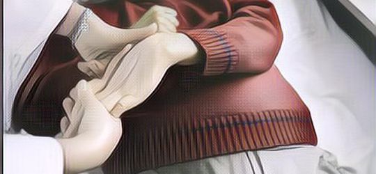 Belajar dari Betharia Sonata, Waspada Gejala Awal Stroke yang Sering Tidak Disadari