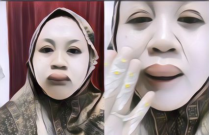 Viral Wanita Bibirnya Mendadak Bengkak 3 Jam Sebelum Akad Nikah! Begini Kondisinya