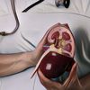 Bikin Haru, Dua Wanita Ini Memutuskan Untuk Donor Ginjal Demi Suaminya Masing-Masing