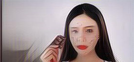 Bisa Timbulkan Masalah Jerawat, Ini Deretan Makanan Pemicu Masalah Kulit