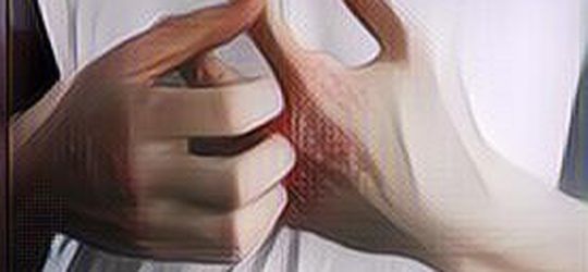 Segala Hal Seputar Dermatitis Seboroik, Penyebab dan Kapan Harus ke Dokter