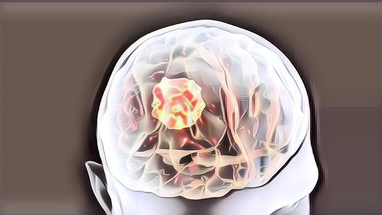 Jangan Anggap Remeh Fungsi Helm! Ini Efek Benturan Keras di Kepala yang Sangat Berbahaya