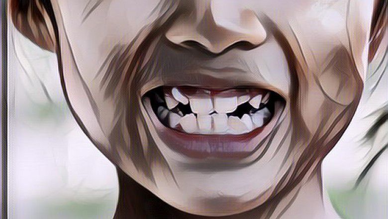 Penjelasan Medis Kenapa Balita Dilarang Pakai Behel, Orangtua Wajib Baca!