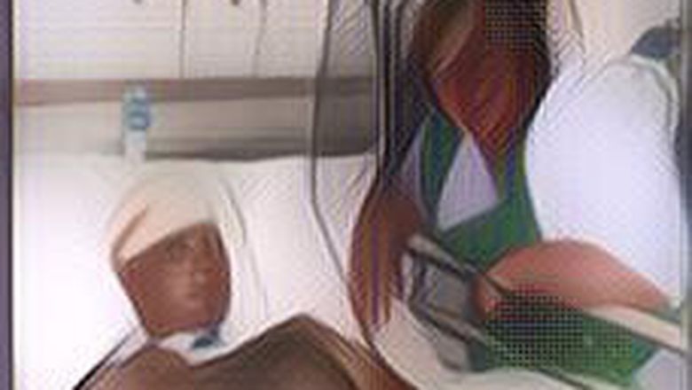 Sebuah Keajaiban, Deretan Orang Ini Tetap Hidup Setelah Kepalanya Tertembak