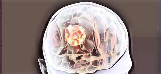 Jangan Anggap Remeh Fungsi Helm! Ini Efek Benturan Keras di Kepala yang Sangat Berbahaya