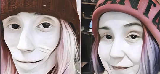 Hidup Wanita Ini Mendekati Kematian, Alami Anoreksia Hingga Berat Badan Turun Jadi 15 Kg