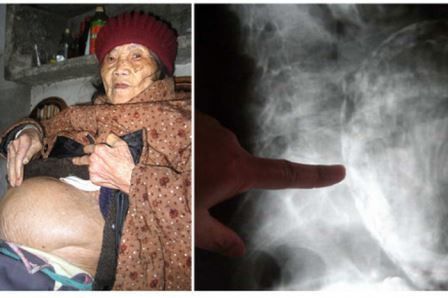 Nenek ini mengandung selama 60 tahun