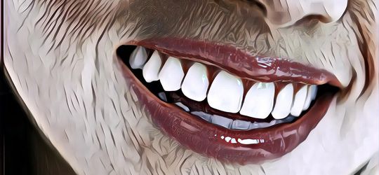 5 Kiat Mudah, Cegah Plak pada Gigi