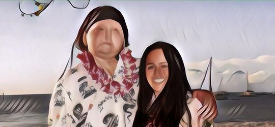 Definisi Cinta Gak Mandang Fisik! Wanita Ini Viral Usai Pacaran Sama Pria Dengan Wajah Hasil Transplantasi