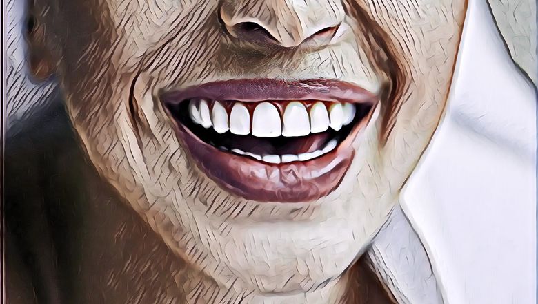 5 Cara Bersihkan Karang Gigi Secara Alami dan Aman Di Rumah