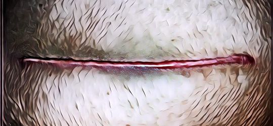 Penyebab dan Cara Menghilangkan Keloid atau Bekas Luka yang Menonjol