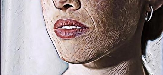 Peran Penting Vitamin D untuk Kesehatan Kulit, Mencegah Penuaan dan Jerawat