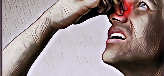 Apa Penyebab Mimisan dan Apakah Terlalu Sering Mimisan Bisa Berakibat Fatal? Begini Penjelasannya