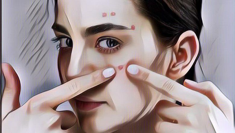 Mudah dan Murah, Ini 5 Bahan Alami Dipercaya Ampuh Hilangkan Bekas Jerawat Menghitam