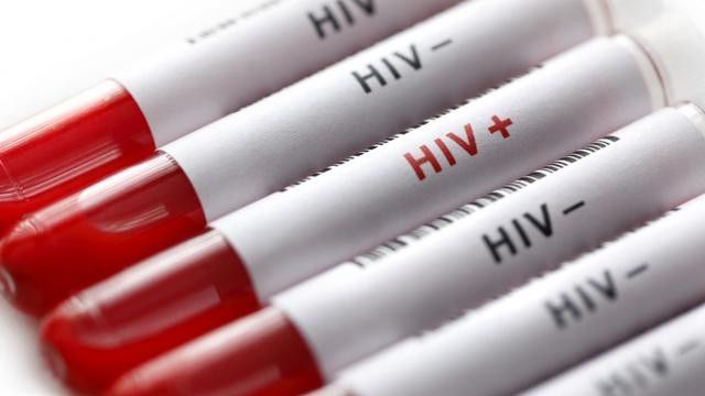 # HIV Tidak Dapat Ditularkan Melalui: