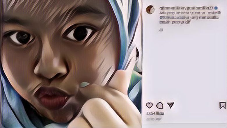Begini Penjelasan Kekeyi Soal Filler Hidungnya yang Viral