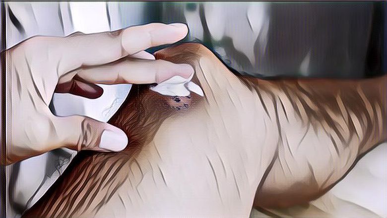 Pakai Herbal Aja! Ini Cara Mengobati Bisul Agar Cepat Kempes