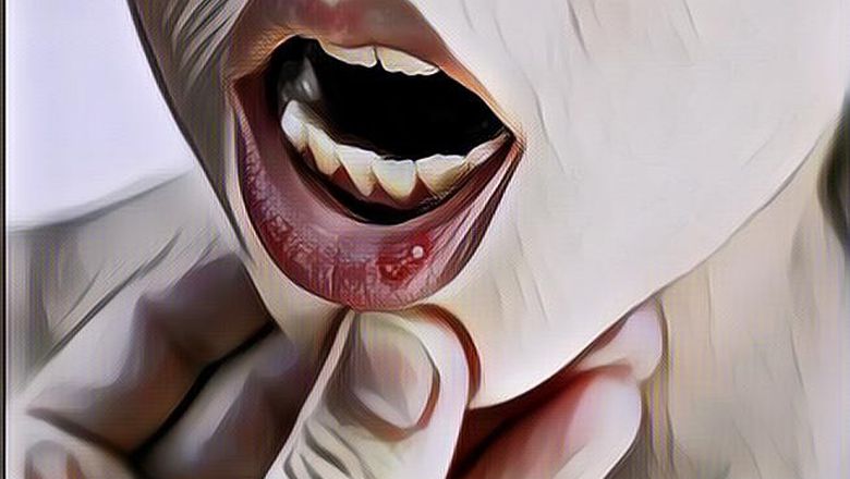 10 Obat Alami yang Bisa Kamu Pakai untuk Menyembuhkan Sariawan