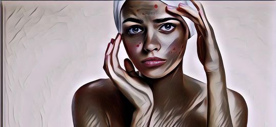 Tips Merawat Kulit Sensitif Agar Tidak Mudah Bermasalah, Lakukan Setiap Hari!