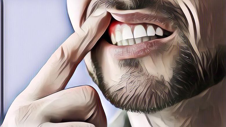 10 Penyebab Kenapa Gusi Kita Sakit, Jangan Anggap Sepele!