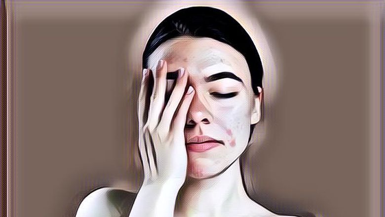 4 Kebiasaan yang Harus Dihindari Saat Kulit Breakout