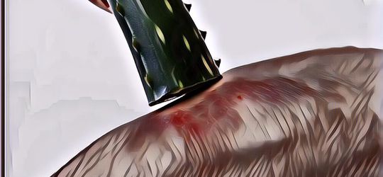 Jangan Pakai Odol, Gini Pertolongan Pertama Saat Kena Knalpot Motor Agar Tidak Melepuh