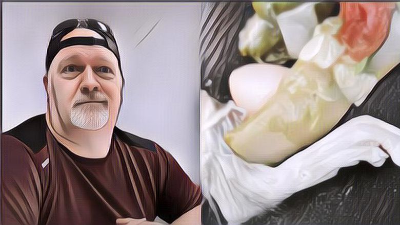 Kisah Pria Trauma Usai Temukan Kaki Tikus Berbulu Di Menu Sup Resto Populer, Kini Depresi Dan Susah Makan