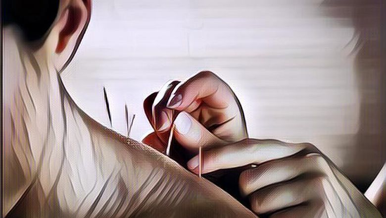Mengenal Cara Kerja Akupuntur dan Manfaatnya untuk Kesehatan