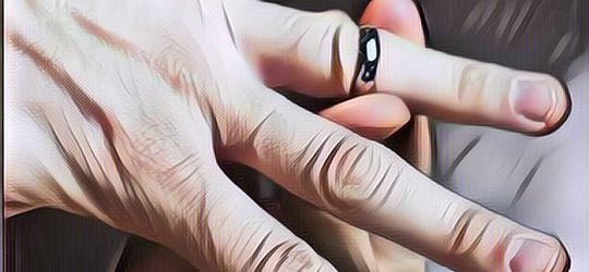 Seorang Pria Minta Bantuan Damkar Usai Cincinnya yang Nyangkut di Penis, Duh Ada-Ada Aja!