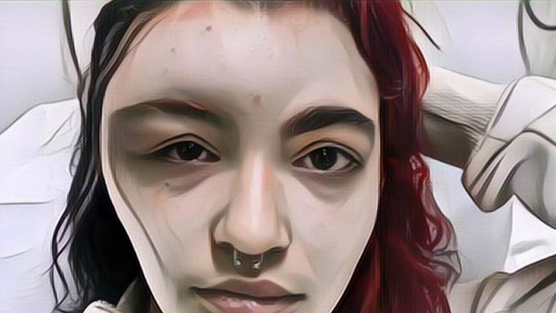 Miris, Wanita Ini Alami Iritasi Cat Rambut, Wajahnya Jadi Bengkak Sebelah