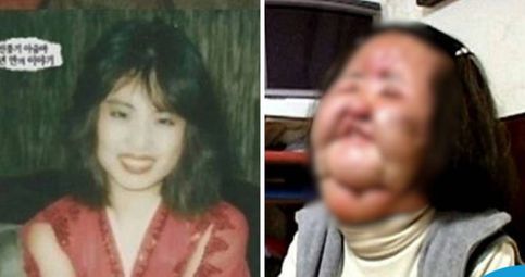 Bikin Nyesek! Aktris Korea Ini Punya Wajah yang Hancur Gara-Gara Gagal Oplas