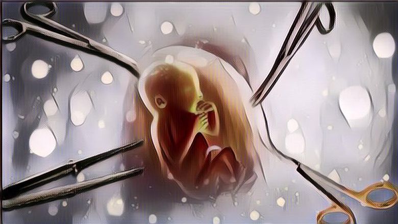 OMG! Aktor Senior 'Grandpas Over Flower' Kim Yong-Gun Paksa Pacarnya untuk Aborsi Karena Alasan Usia Lanjut