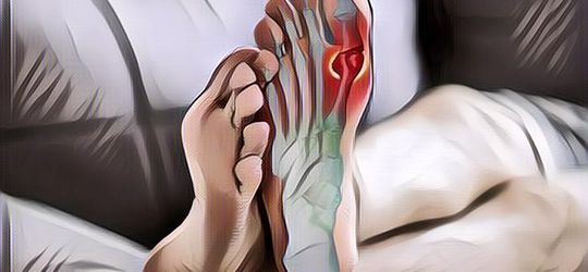 Kenali Beragam Bahan Alami untuk Menurunkan Asam Urat