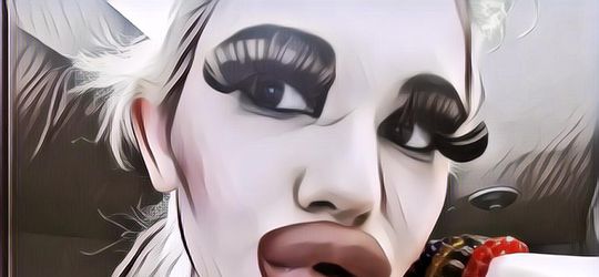 Obsesi Cewek Ini Punya Bibir Terbesar di Dunia, Bikin Ngeri Gak Sih?