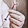 Waduh! IUD dan Pil KB Ternyata Tingkatkan Risiko Wanita Terkena Kanker Payudara, Ungkap Studi Terbaru